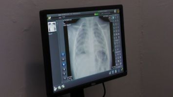  / Новини от Казанлък