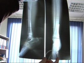 С Открито писмо родители бранят учителка / Новини от Казанлък