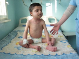 11-годишно дете от Казанлък е в много тежко състояниe / Новини от Казанлък