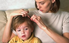 Въшки в училища и детски градини в Казанлък / Новини от Казанлък