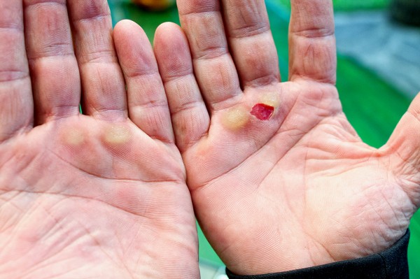 Утре от връх Шипка стартира “Чесън и скариди“