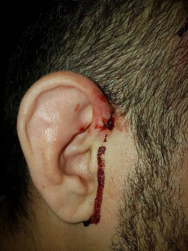 Полицията задържа един по един нападателите от снощния побой между цигани и българи в Дунавци