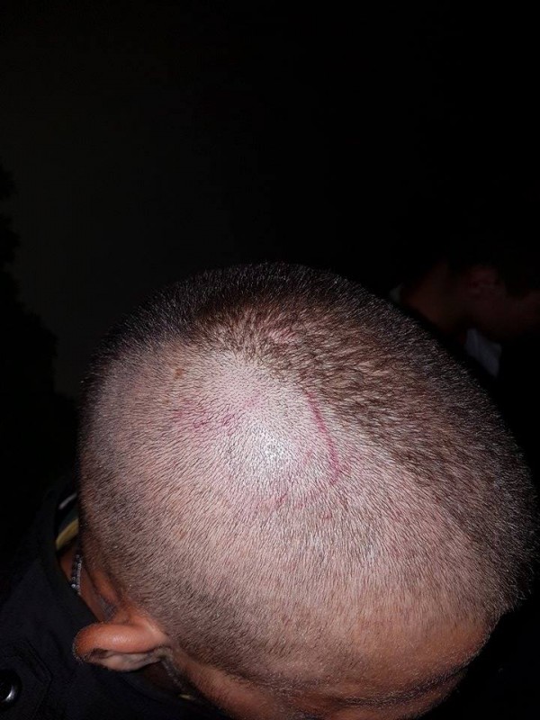 Полицията задържа един по един нападателите от снощния побой между цигани и българи в Дунавци