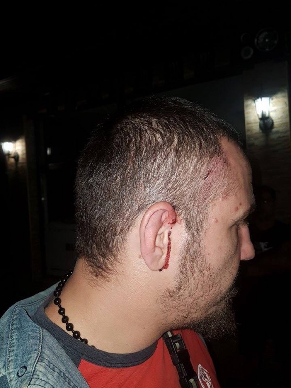 Полицията задържа един по един нападателите от снощния побой между цигани и българи в Дунавци