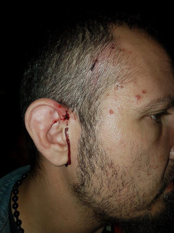 Полицията задържа един по един нападателите от снощния побой между цигани и българи в Дунавци