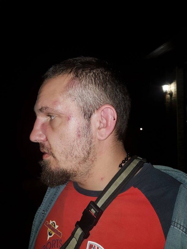 Полицията задържа един по един нападателите от снощния побой между цигани и българи в Дунавци