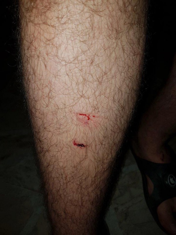 Полицията задържа един по един нападателите от снощния побой между цигани и българи в Дунавци