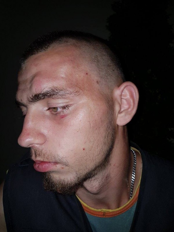 Полицията задържа един по един нападателите от снощния побой между цигани и българи в Дунавци