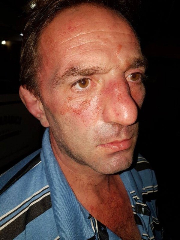 Полицията задържа един по един нападателите от снощния побой между цигани и българи в Дунавци