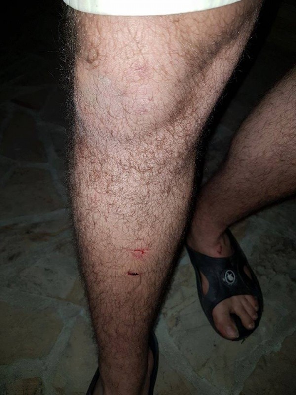 Полицията задържа един по един нападателите от снощния побой между цигани и българи в Дунавци