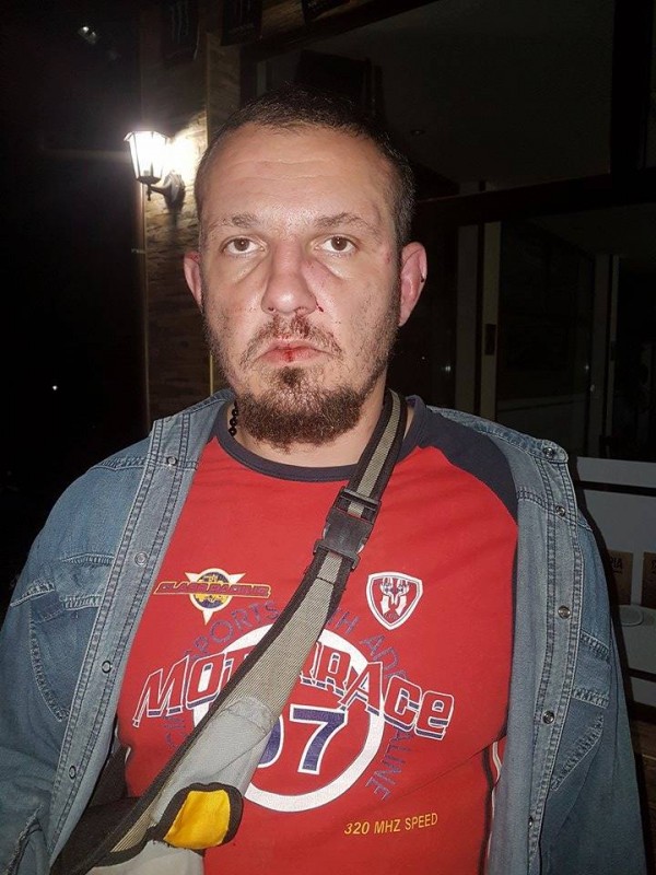 Полицията задържа един по един нападателите от снощния побой между цигани и българи в Дунавци