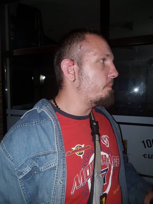 Полицията задържа един по един нападателите от снощния побой между цигани и българи в Дунавци