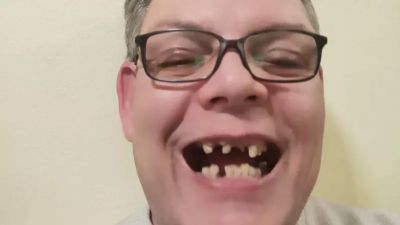 Казанлъчанин има нужда от средства за спешна дентална операция 