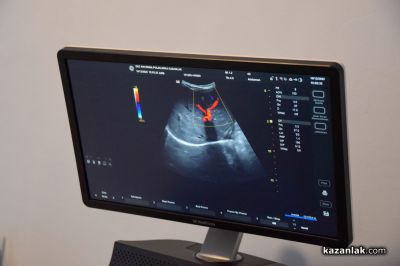 Последно поколение дигитална рентгенова техника и мамограф „Сименс“ вече в “ДКЦ Районна поликлиника - Казанлък“