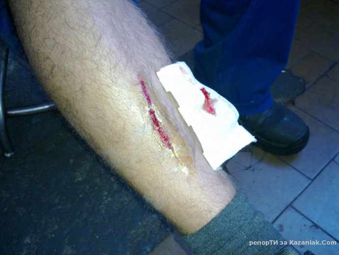 И вървенето по тротоара вече е опасно...