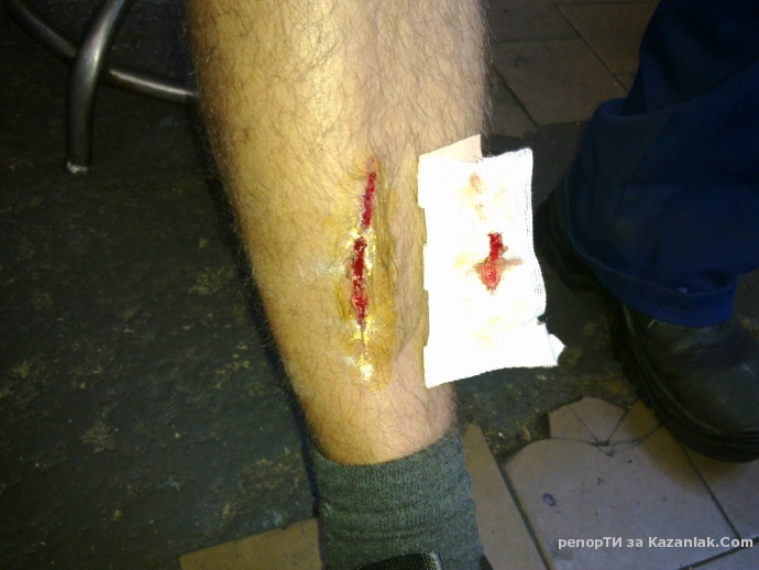 И вървенето по тротоара вече е опасно...